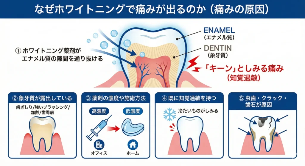 痛みの原因
