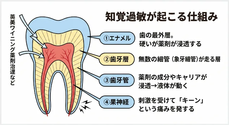 歯の断面図