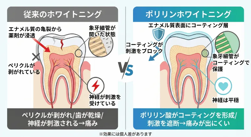 メカニズムの違いの図解